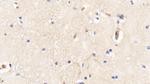 Hemoglobin Antibody in Immunohistochemistry (Paraffin) (IHC (P))