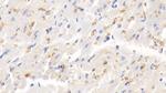 Hemoglobin Antibody in Immunohistochemistry (Paraffin) (IHC (P))