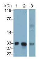 MBL2 Polyclonal Antibody