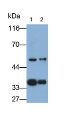 PTK9 Polyclonal Antibody