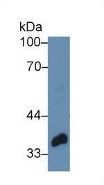 PTK9 Antibody in Western Blot (WB)