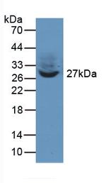 PTK9 Antibody in Western Blot (WB)