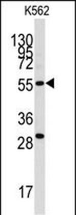 CLIC5 Antibody in Western Blot (WB)