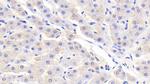 RBP5 Antibody in Immunohistochemistry (Paraffin) (IHC (P))