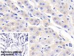 RBP5 Polyclonal Antibody