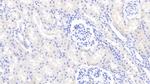 RBP5 Antibody in Immunohistochemistry (Paraffin) (IHC (P))