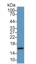 RBP5 Antibody in Western Blot (WB)