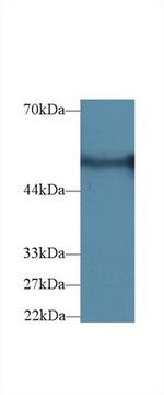 G6PD Polyclonal Antibody