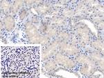 ANGPTL1 Polyclonal Antibody