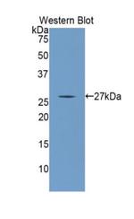ANGPTL1 Antibody in Western Blot (WB)