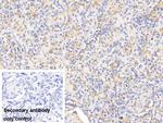 Hemoglobin Antibody in Immunohistochemistry (Paraffin) (IHC (P))