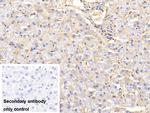 Hemoglobin Antibody in Immunohistochemistry (Paraffin) (IHC (P))