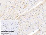 Hemoglobin Polyclonal Antibody