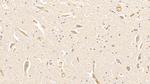Hemoglobin Antibody in Immunohistochemistry (Paraffin) (IHC (P))