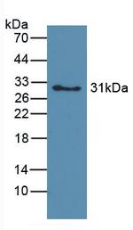 Hemoglobin Antibody in Western Blot (WB)