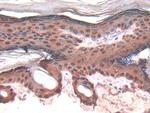 Galectin 7 Antibody in Immunohistochemistry (Paraffin) (IHC (P))