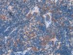 Galectin 7 Antibody in Immunohistochemistry (Paraffin) (IHC (P))