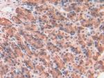 Galectin 7 Antibody in Immunohistochemistry (Paraffin) (IHC (P))