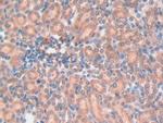 Galectin 7 Antibody in Immunohistochemistry (Paraffin) (IHC (P))