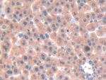 Galectin 7 Antibody in Immunohistochemistry (Paraffin) (IHC (P))