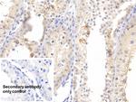 Pleiotrophin Polyclonal Antibody