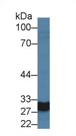 Carbonic Anhydrase VA Polyclonal Antibody