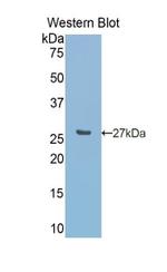 Carbonic Anhydrase VA Antibody in Western Blot (WB)