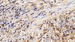 IL13RA2 Antibody in Immunohistochemistry (Paraffin) (IHC (P))
