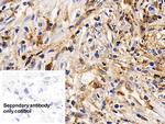 IL13RA2 Antibody in Immunohistochemistry (Paraffin) (IHC (P))