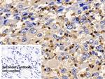 IL13RA2 Polyclonal Antibody