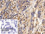 IL13RA2 Antibody in Immunohistochemistry (Paraffin) (IHC (P))