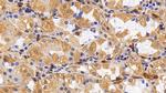 IL13RA2 Antibody in Immunohistochemistry (Paraffin) (IHC (P))