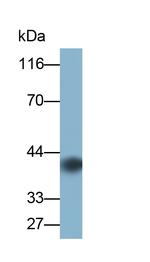 IL13RA2 Antibody in Western Blot (WB)