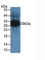 Tryptase Polyclonal Antibody