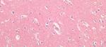 BACE2 Antibody in Immunohistochemistry (Paraffin) (IHC (P))