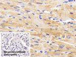 BACE2 Polyclonal Antibody