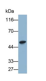 BACE2 Antibody in Western Blot (WB)