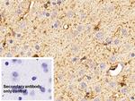 S100B Antibody in Immunohistochemistry (Paraffin) (IHC (P))
