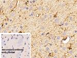 S100B Antibody in Immunohistochemistry (Paraffin) (IHC (P))
