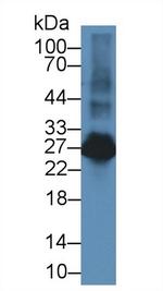 NTAL Antibody in Western Blot (WB)
