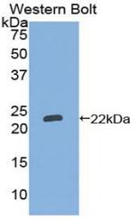 NTAL Antibody in Western Blot (WB)