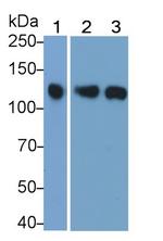 JAK3 Polyclonal Antibody