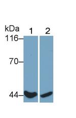 CD64 Polyclonal Antibody