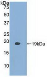 FABP9 Antibody in Western Blot (WB)
