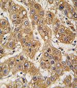 APOE Polyclonal Antibody