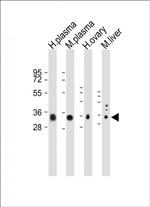 APOE Antibody in Western Blot (WB)