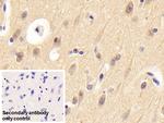 Neuritin Polyclonal Antibody