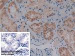PKC mu Antibody in Immunohistochemistry (Paraffin) (IHC (P))