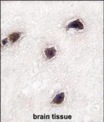 CABP1 Polyclonal Antibody