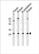 CABP1 Antibody in Western Blot (WB)